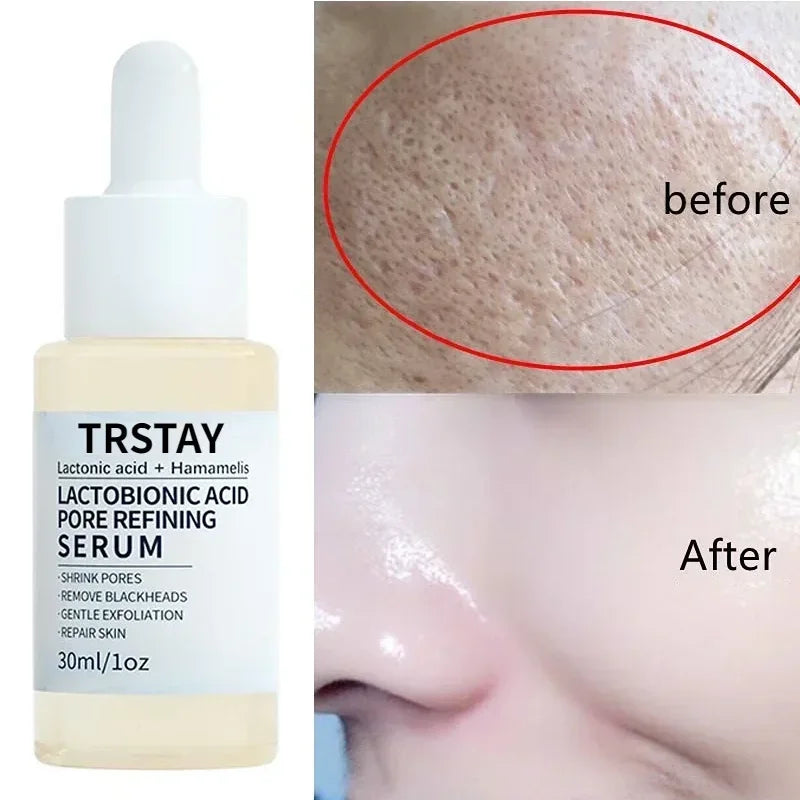 Pore Shrinking Face Serum Removing Large Pore Tightening Repairing Facial Pore Minimizing Purify Pore Whitening Skin Care